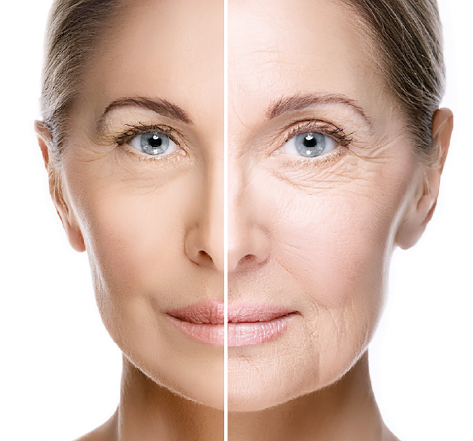 Bioregen - Bioinduttivo multifrazionato