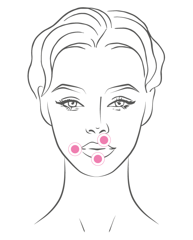 Regenyal Idea Lips - Biorivolumetria