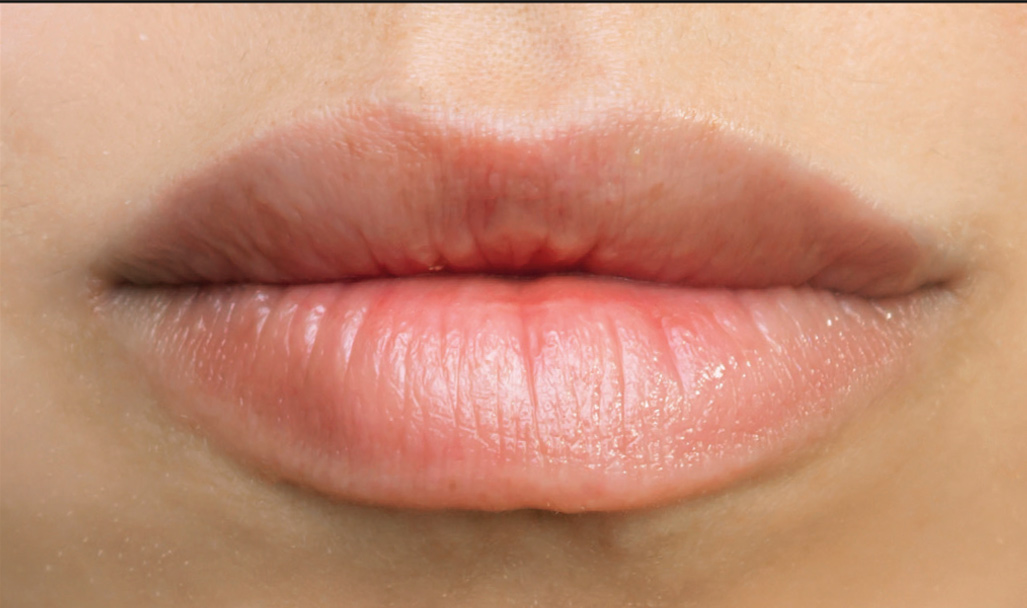 Regenyal Idea Super Lips