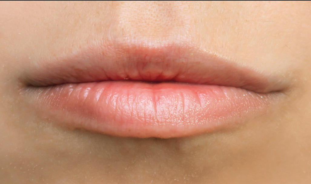 Regenyal Idea Super Lips