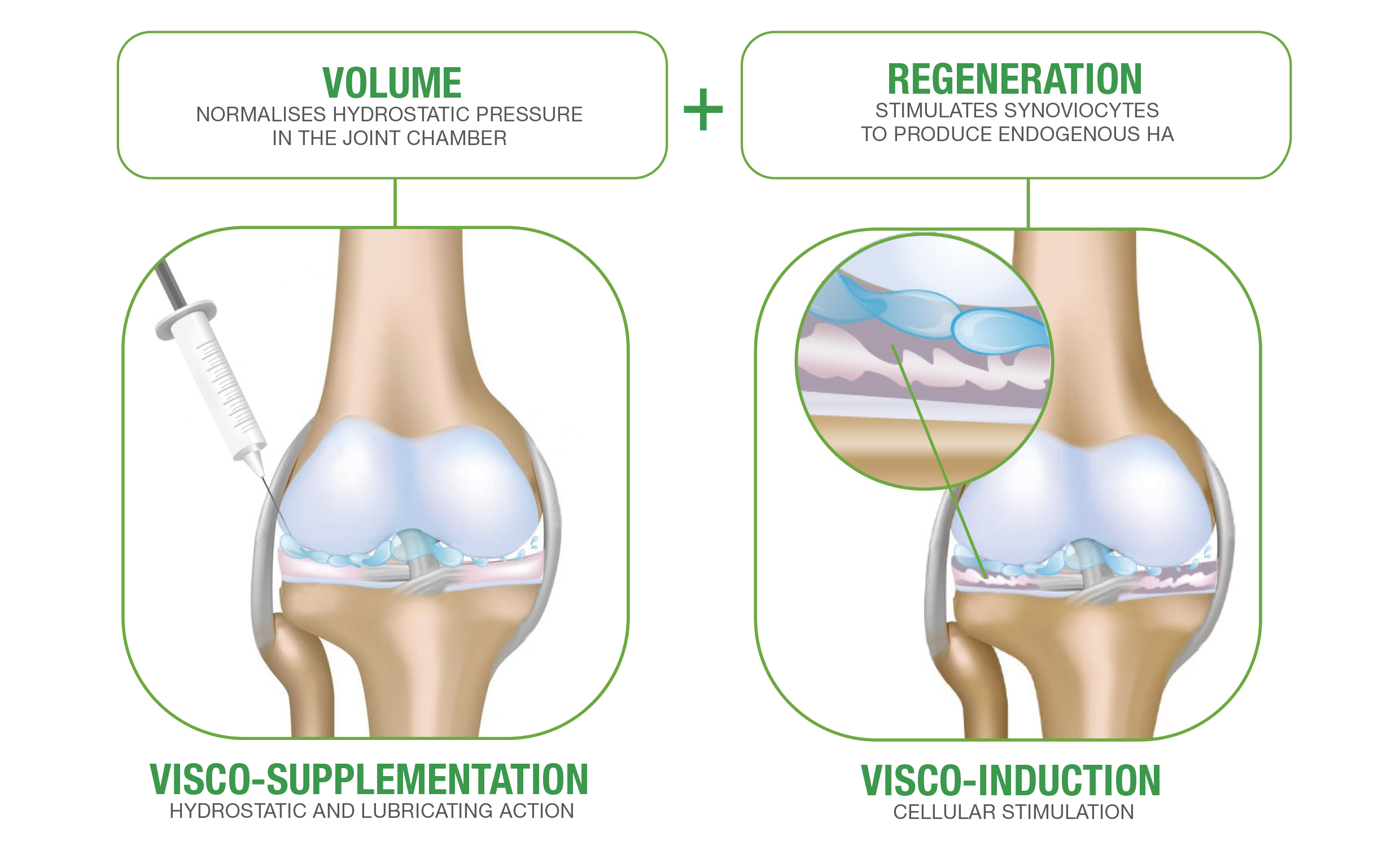 Regenflex BIO-PLUS Light
